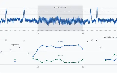 Two stacked panels over 0 to 30 s. EEG panel: the synthetic record in µV, from −46.3 to 111.5, against dotted reject levels at plus and minus 75 µV; four blinks rise above the upper one; the eyes-closed span, 10 to 20 s, is shaded. Relative band power panel: 29 windows of 29 drawn, centred at 1 to 29 s; alpha's share as dots on a solid line, delta's as squares on a dashed line; 10 rejected windows (centred at 2, 3, 4, 6, 7, 8, 21, 22, 23 and 24 s) shown as open crosses at their delta share. Span 20 to 30 s: alpha 22 %, delta 28 %, mean over the kept windows.